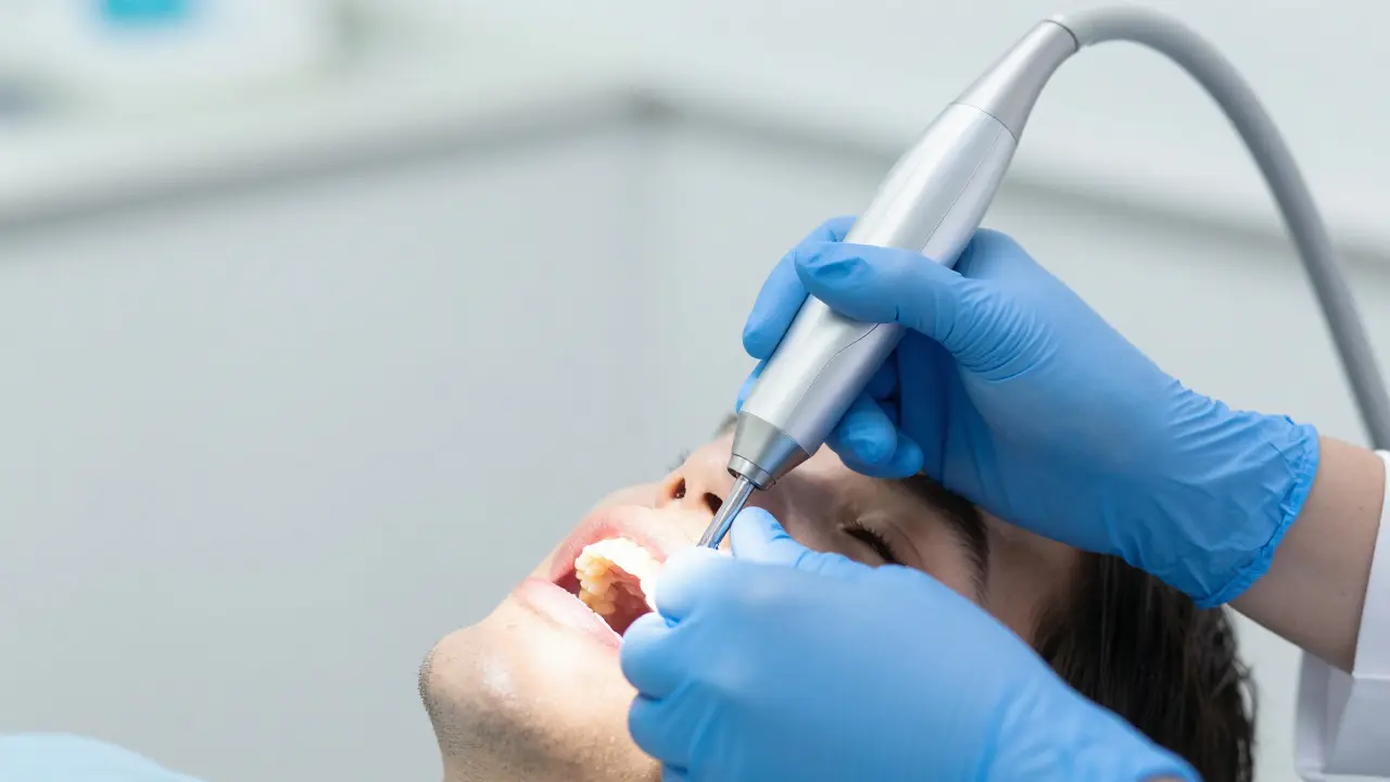 Jak dlouho trvá dentální hygiena? Čas, cena a spojení s keramickými fazetami